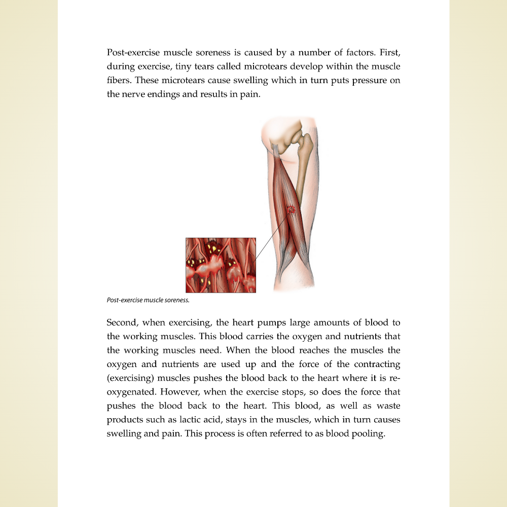 The Anatomy of Sports Injuries, Second Edition: Your Illustrated Guide to Prevention, Diagnosis, and Treatment by Brad Walker